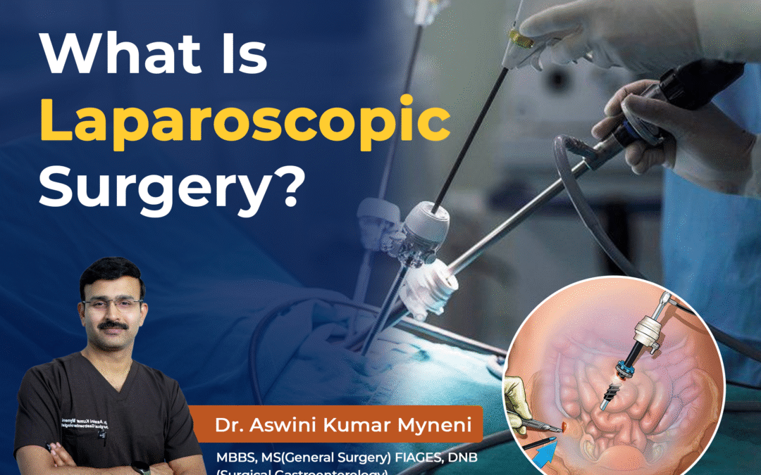 What Is Laparoscopic Surgery? Types, Benefits, Risks, and Recovery